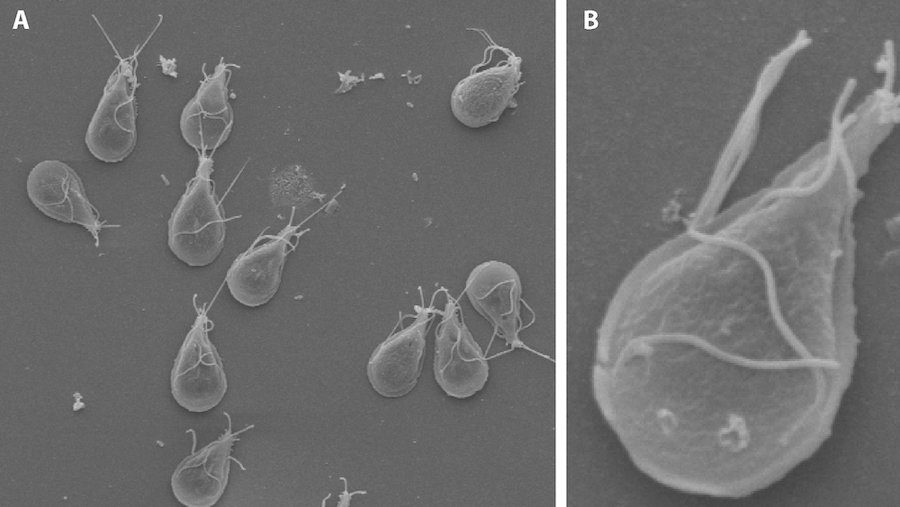 Figure 4. Scanning electron micrographs of Giardia trophozoites, Image A shows multiple organisms; B shows a close-up.